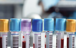 Blood Tubes with Color Block e1534811352247 آزمایشگاه ژنتیک پزشکی و پاتوبیولوژی فجر ساری
