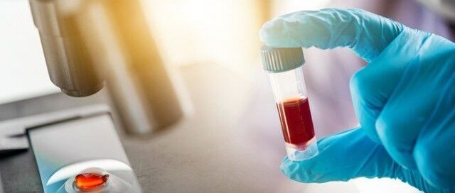 تست آنتی بادی