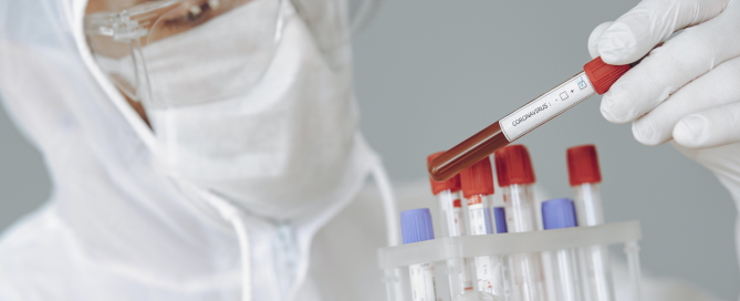 تست کرونا در منزل